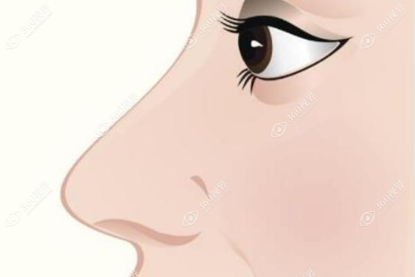硅胶隆鼻好还是膨体好.jpg 硅胶隆鼻好还是膨体好.jpg