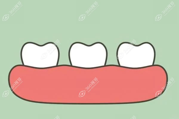 无挂钩镶牙价格.jpg 无挂钩镶牙价格.jpg