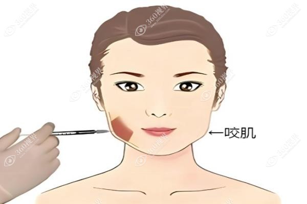 全脸微调到底调哪里？一份超全项目清单与价格对应表，看完就懂！