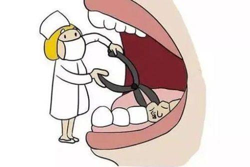 美冠塔囗腔镶牙收费标准：普通活动假牙全口2k/瑞典ITI种植牙15.8k/全口无挂钩镶牙15W