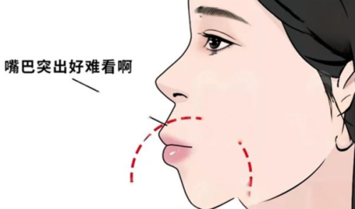 国内十大正颌医生是谁？何锦泉、曹栋弼、穆雄铮等医生排名前十，真有这么厉害吗？ 