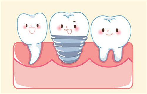 什么叫半固定种植牙?种植半固定和全固定在稳定性等方面有明显区别 