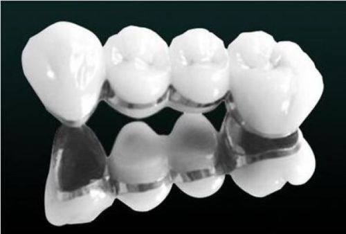 美国zimmer种植体型号：一文揭秘zimmer种植体各型号优缺点，附带超全价格！ 