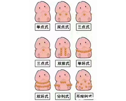 黄学峰消除富贵包多少钱？分档定价I型起价19800元，快来了解黄学峰富贵包矫正方法！