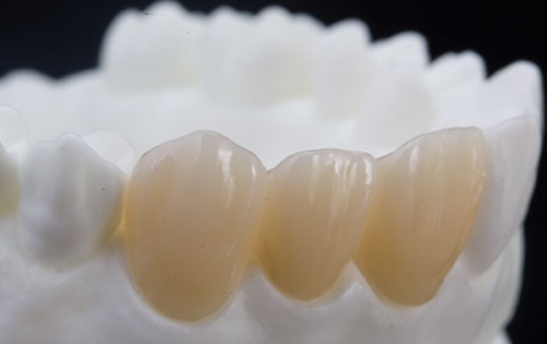 昆明美奥口腔收费高吗?韩国登腾2980-4880元起/瑞士6359元起/半口1.8w+