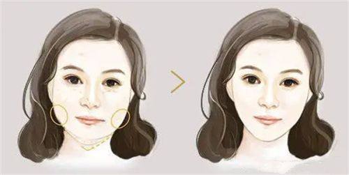 男士埋珠手术费用一览表，2025年单颗珠子普通医院1000 - 3000元，一般男性埋珠要恢复1 - 2个月左右