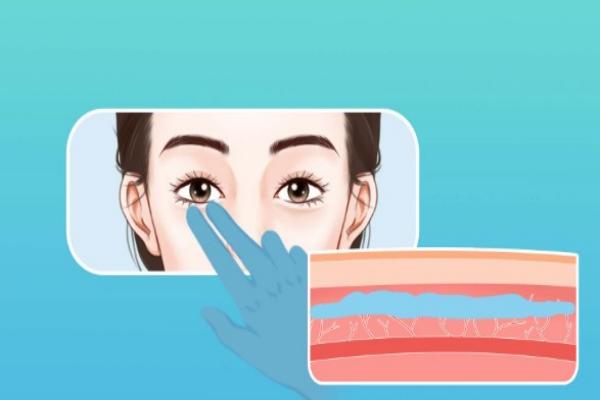 郑州新美颜整形医院去眼袋可以吗？当然，专业医生操刀去眼袋价格5千起，快冲！