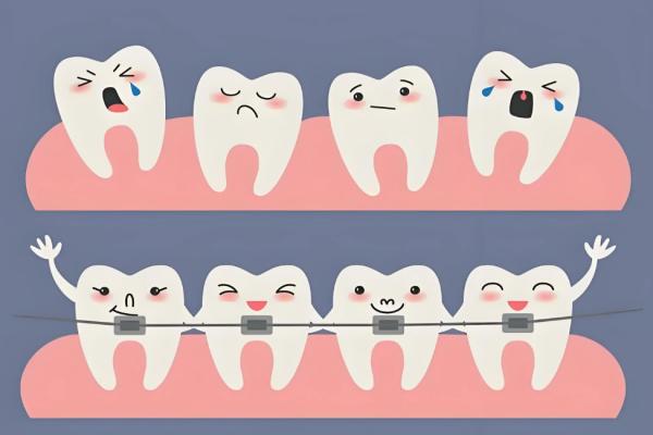 为什么16岁不建议矫正牙齿?此时骨骼发育情况特殊/最佳年龄是10岁左右