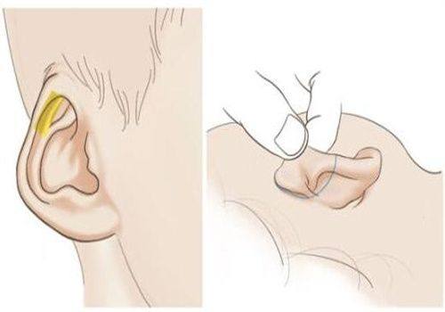 国内人工造假耳朵手术医院：上榜前三的是美莱/艺星/伊美尔医疗美容医院！