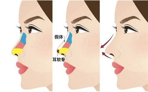 二、成都新丽美医疗美容医院技术怎么样?