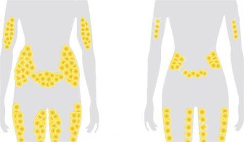 韩国腰腹环吸便宜还是内地环吸便宜？韩国腰腹环吸VS腰腹环吸费用对比!一文便知谁更贵~