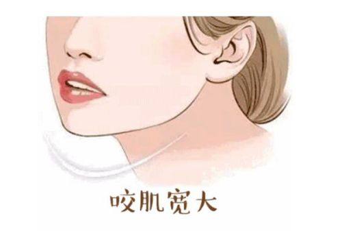 少女针品牌哪个好？看这份超全少女针品牌排行榜，热门品牌推荐别错过！ 