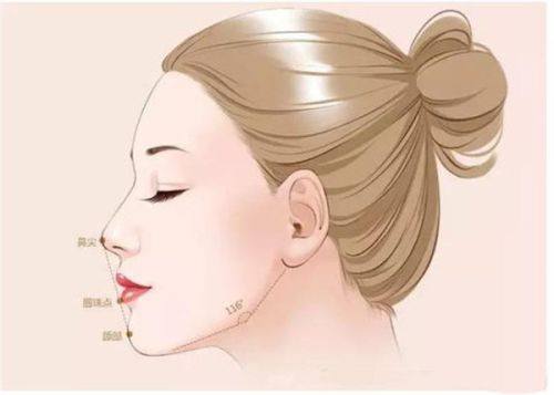 东莞做膨体隆鼻手术哪家好？东莞壹加壹/美立方/维多利亚上榜前三！ 