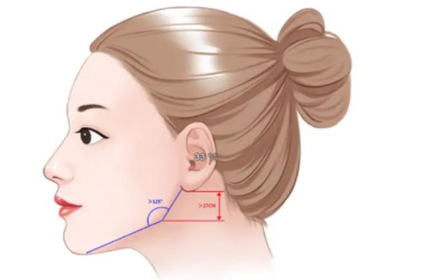 双颚手术多少钱？大概几万元到十几万元，术后一个月别用抗凝药物等注意事项全分享