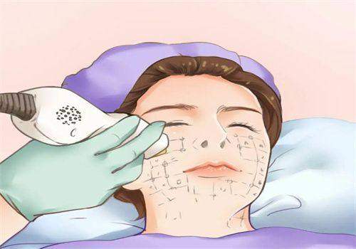 打脸部紧致针前后对比变化？打脸部紧致针效果明显,好处多多！