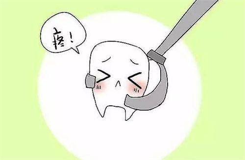 深圳牙科拔牙多少钱一颗？残根残冠100-300元左右/上颌正位智齿500-1000元左右