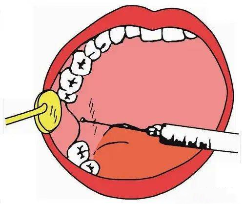 昆明华美美莱祛疤靠谱吗?昆明华美美莱祛疤痕修复中心靠谱/获众多患者好评