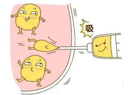 武汉五洲杨水斌医生做鼻子好吗?当然好!个性化定制美鼻效果好/附做鼻子案例