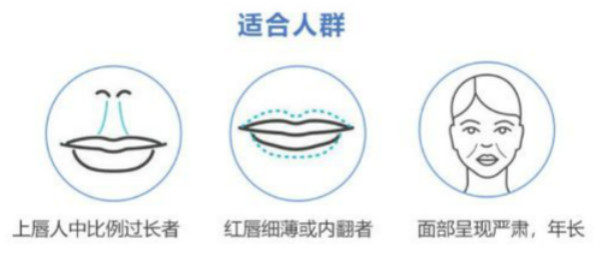 范开防手术的口碑和评价：范开防做人中手术不留痕/恢复快好评多多！