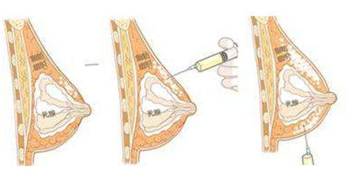 中山秀妍医疗美容医院