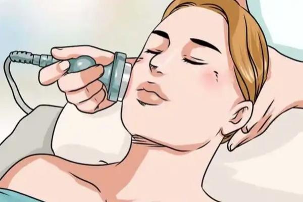 成都素美李建刚做筋膜提升案例：分层提拉自然抗衰，真能维持三到五年，3.8万起真香