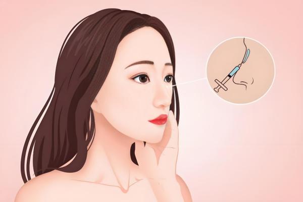 成都周顺波做鼻子好不好？桥型双拱鼻支架+微痛取肋技术，术后可自由活动，价格14000起