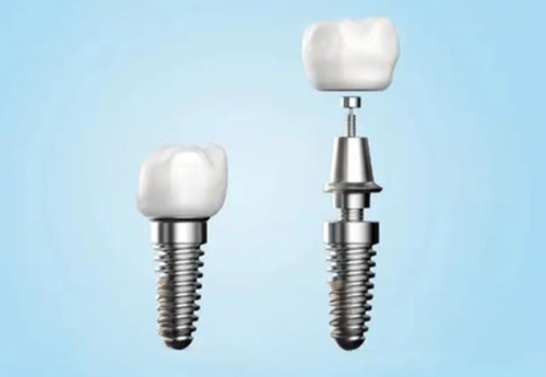 陕西西安团圆口腔医院好不好？规模大环境优、项目多价格美，顾客反馈超棒值得来