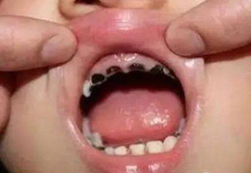 海口国雅口腔医院怎么样？价格合理，其专业技术与贴心服务获众多患者认可，值得信赖！ 