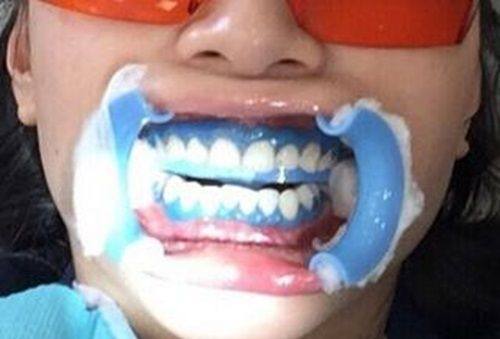 海南微笑口腔医院收费标准：洗牙99+/种植牙2980起矫正5k起，透明定价性价比高