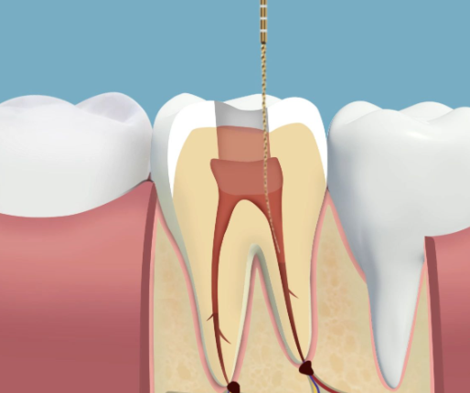 海口国雅口腔医院种植牙怎么样？价格亲民！其技术专业、医生靠谱，种植牙效果值得信赖！ 
