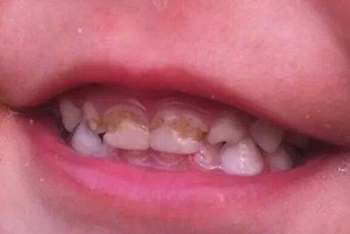 三、牙博士口腔收费贵吗？www.360tulou.com/