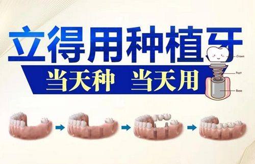 赣州牙博士口腔医院是正规医院吗？数字化种植技术成熟收费透明，亲测效果稳固值得选