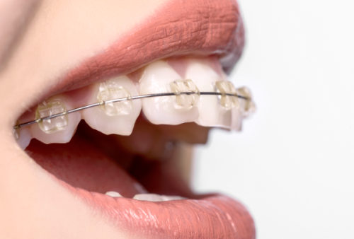 爵冠口腔医院是正规的吗？数字化种植技术精湛且收费透明，亲测效果稳固可靠值得选