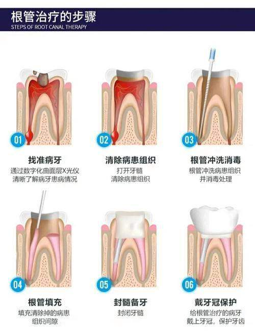 北京爵冠口腔医院收费标准？种牙 2953 元起补牙 98 元，透明报价放心选！