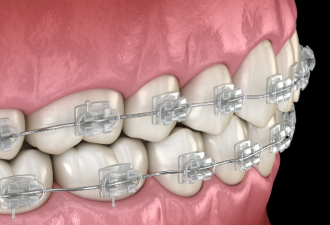 赣州牙博士口腔在哪里？院内数字化种植技术精湛收费合理，地址明确服务贴心值得选择