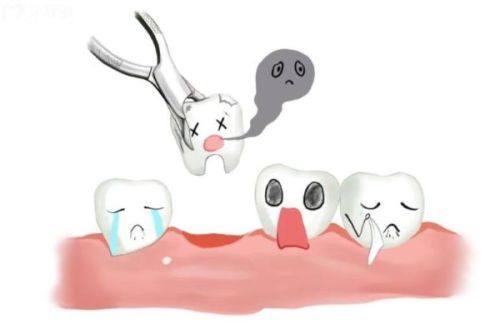 莆田牙先生口腔怎么样技术精湛价格适中，亲测数字化种植稳固耐用且收费透明合理超安心