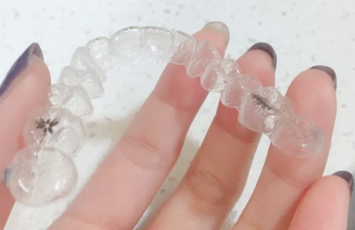 麦田口腔属于什么档次？中高端定位技术精湛收费合理，亲测种植稳固舒适值得选择