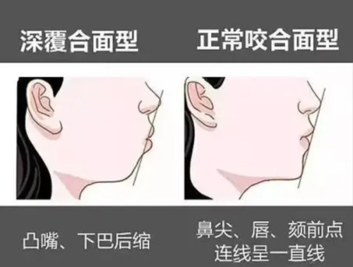 承德名士口腔1280元种植牙可靠吗？先进数字化种植技术加持，口碑靠谱值得选择