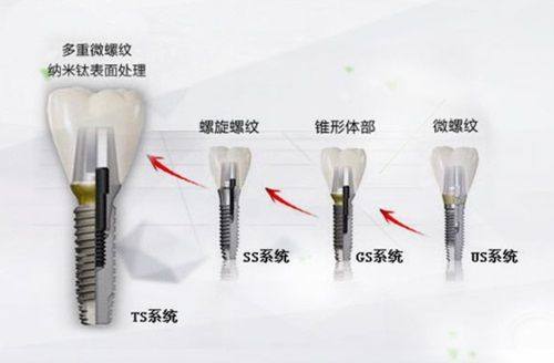 宁波恒美口腔牙齿矫正怎么样？数字化正畸让侧貌更精致，收费透明