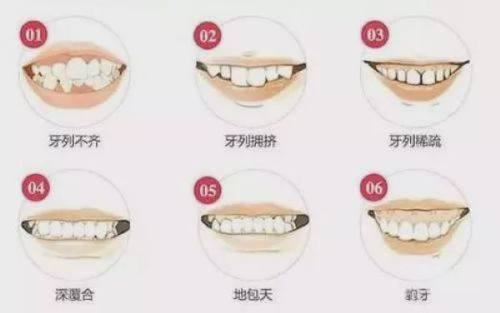 武汉左岭博牙口腔收费合理吗？确实亲民，种牙矫正价格透明还享补贴