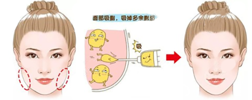 合肥徐和林眼综合做的好吗；动态重睑技术术后无痕自然妈生款审美风格受好评