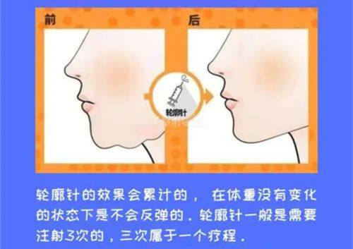 哈尔滨星面孔超声炮价格大降现在入手划算吗？趁优惠变美正当时轻松拥有紧致轮廓。