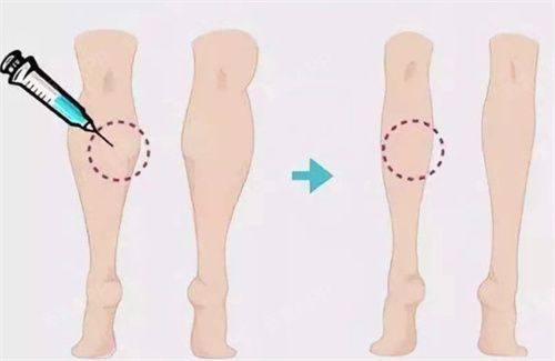 北京和颜美帕正规吗？是正规机构主打分层抗衰技术，价格区间合理效果自然。