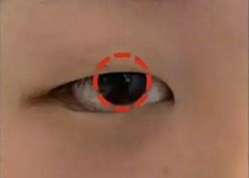 杭州星纪医疗美容技术怎么样？院内主打微创抗衰技术效果自然持久受好评