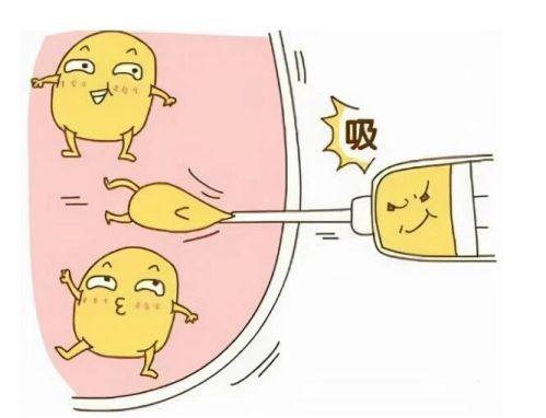 杭州清锴整形医院李保锴怎么样？鼻部整形技术精湛效果自然备受好评