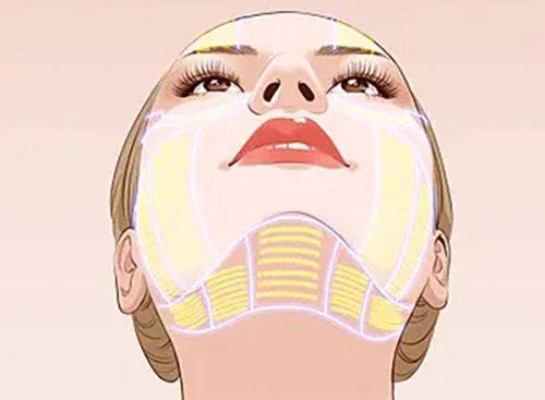 杭州天鑫艾长安隆胸怎么样？内窥镜双平面技术塑造自然胸型手感真实形态美