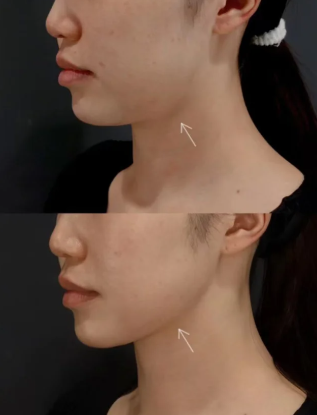 杭州至妍医疗美容靠谱吗？院内主打微创抗衰技术，效果自然持久获好评