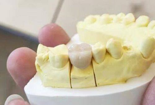 哈尔滨赛弗口腔地址在南岗区，主打数字化种植技术收费合理，亲测效果稳固值得放心选择