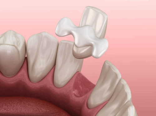 北京维恩口腔正规吗？资质齐全技术精，特色种植稳收费透明合理值得选