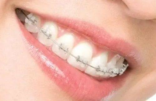 哈尔滨赛弗口腔门诊部地址在哪？技术精湛价格亲民，院内数字化种植让缺牙重生稳固如初。